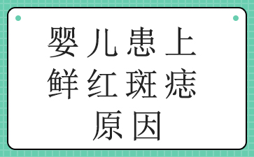 广州鲜红斑痣治疗费用-婴儿患上鲜红斑痣原因